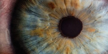 An eye